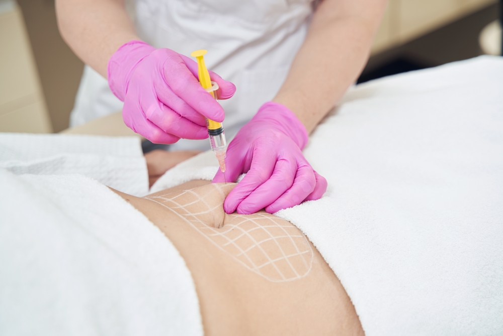 Everything You Need to Know About Fat Dissolving Injections