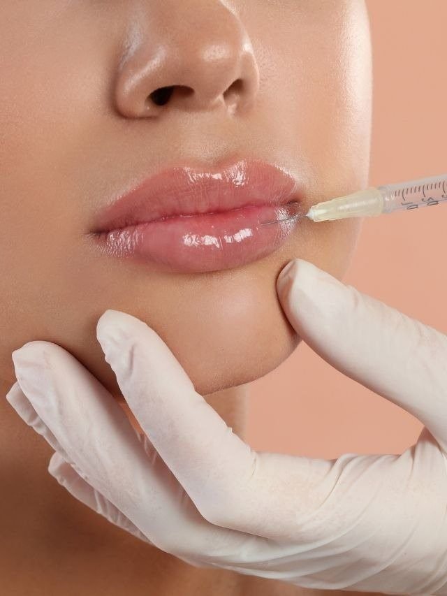 Lip Flip Before and After: A Subtle Way to Enhance Your Lips