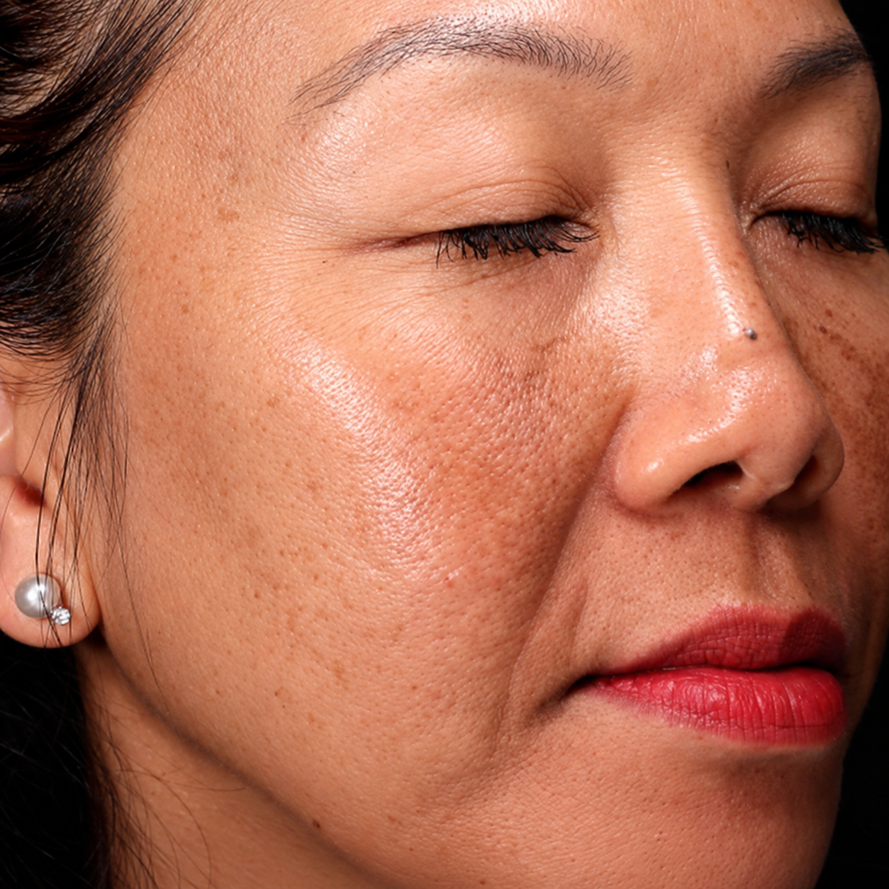 Before treatment