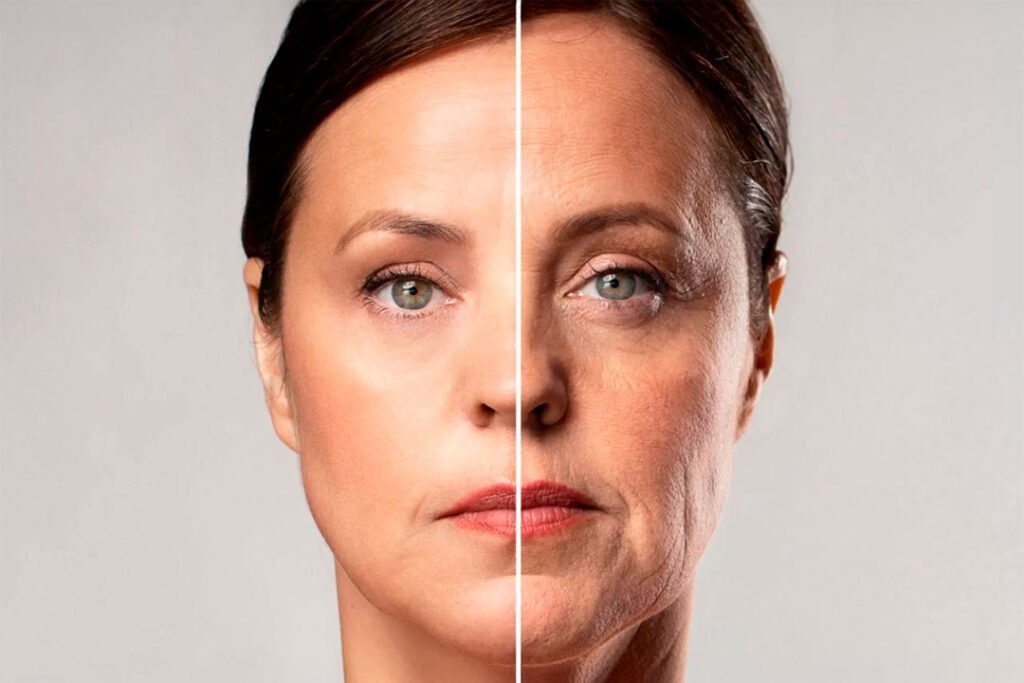 Sculptra Before and After: Natural Collagen Stimulation and Long-Term Skin Firmness