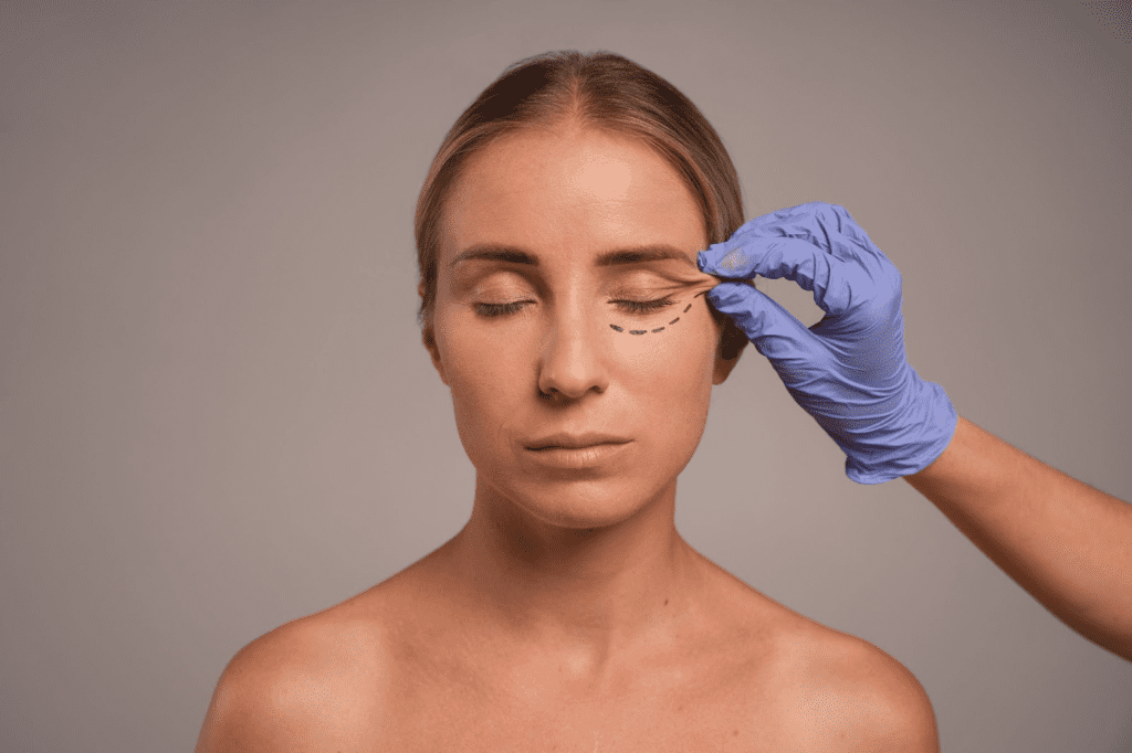 Tear Trough Dermal Filler: A Subtle Treatment for Under-Eye Hollows
