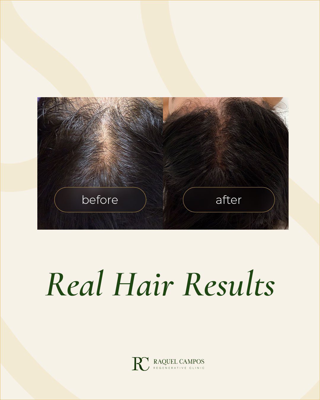 Hair treatment results