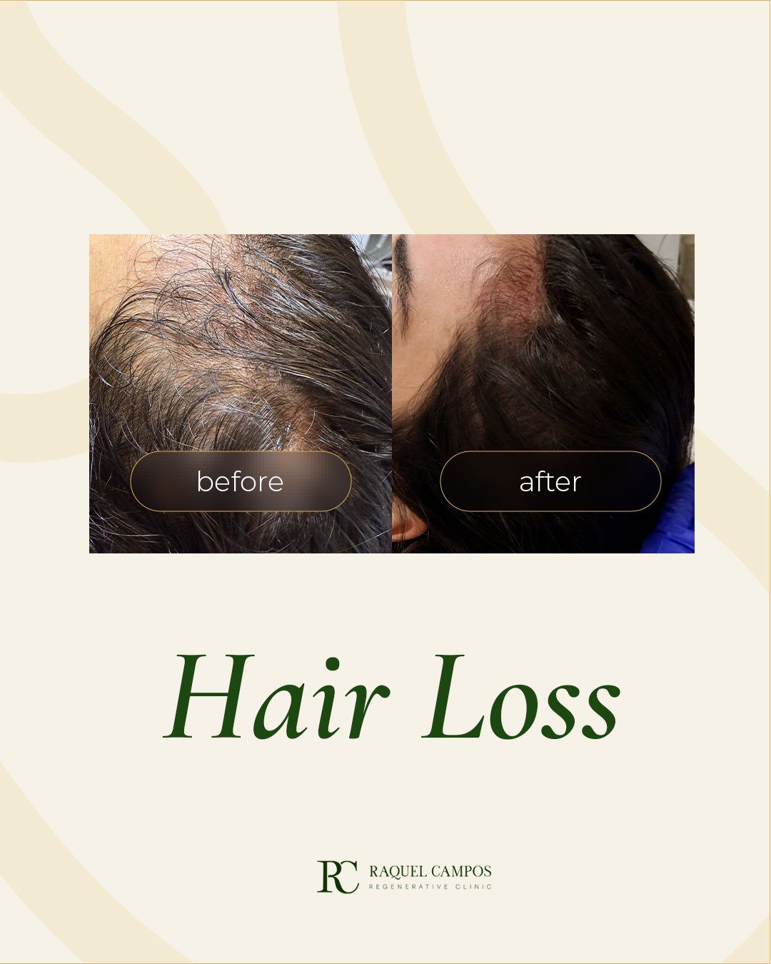 Hair treatment before and after