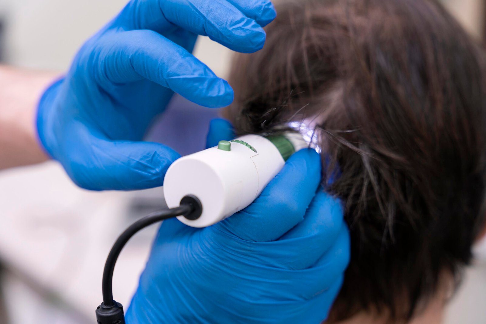Laser Hair Treatment